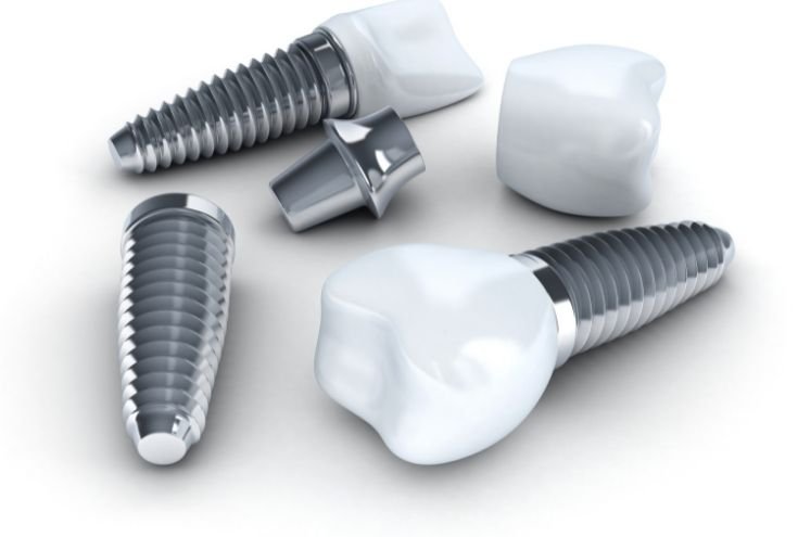 Image of dental implants and its parts uninstalled