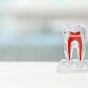 Image of a model of a tooth wherein the enamel is transparent so you can see the pulp which is coloured red