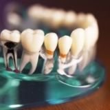 Image of a 3d model of teeth