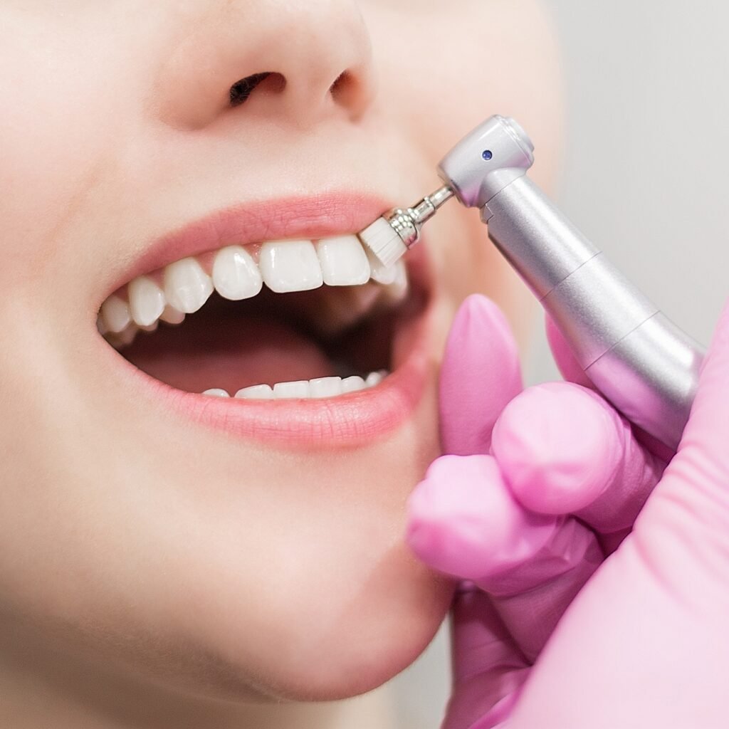 Closeup image of a lady's teeth being brushed with an electronic toothbrush during a dental cleaning by a hygienist