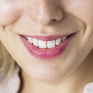 Image of a lady's smile showing high-quality veneers