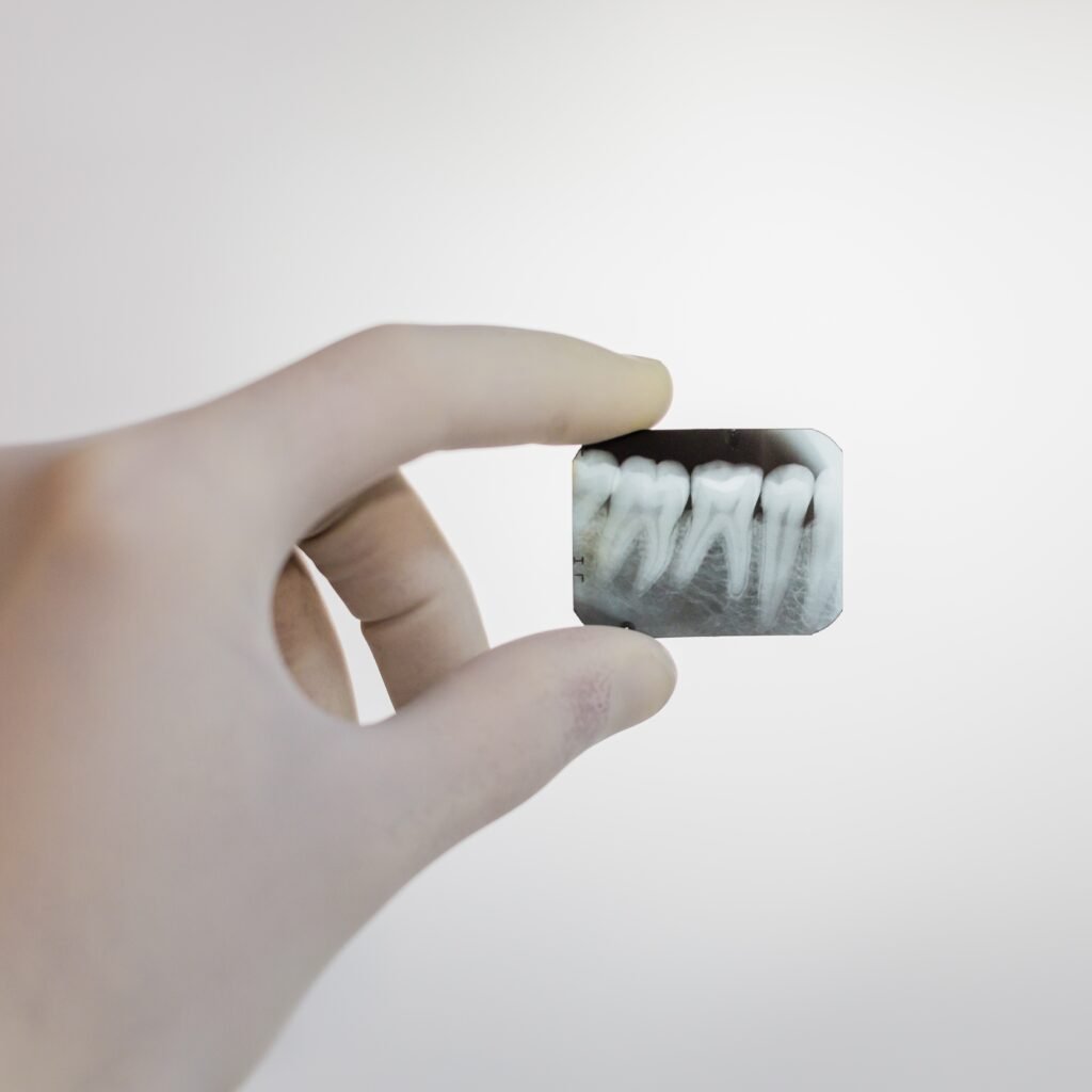 Image showing a hand holding a printed dental x-ray result between the index finger and the thumb