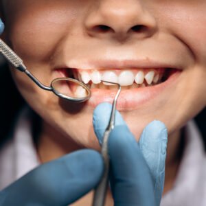 Closeup image of a young patient's teeth as a dental practitioner checks them with a dental mirror and scraper