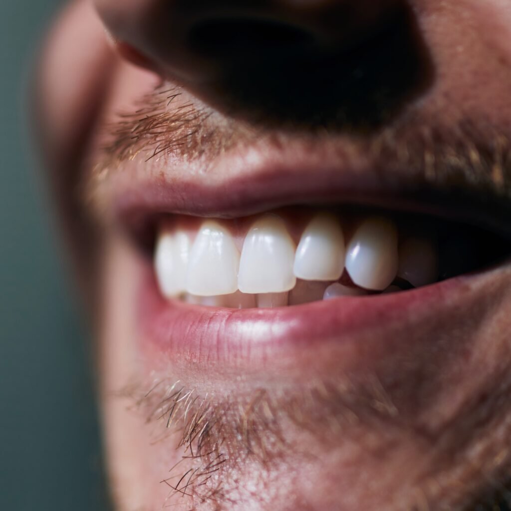 Closeup image of a man's smile with invisible braces