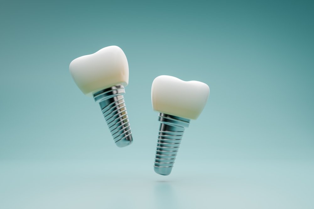 Two dental implants with metal screw bases and white tooth-shaped tops are floating against a smooth, teal background.